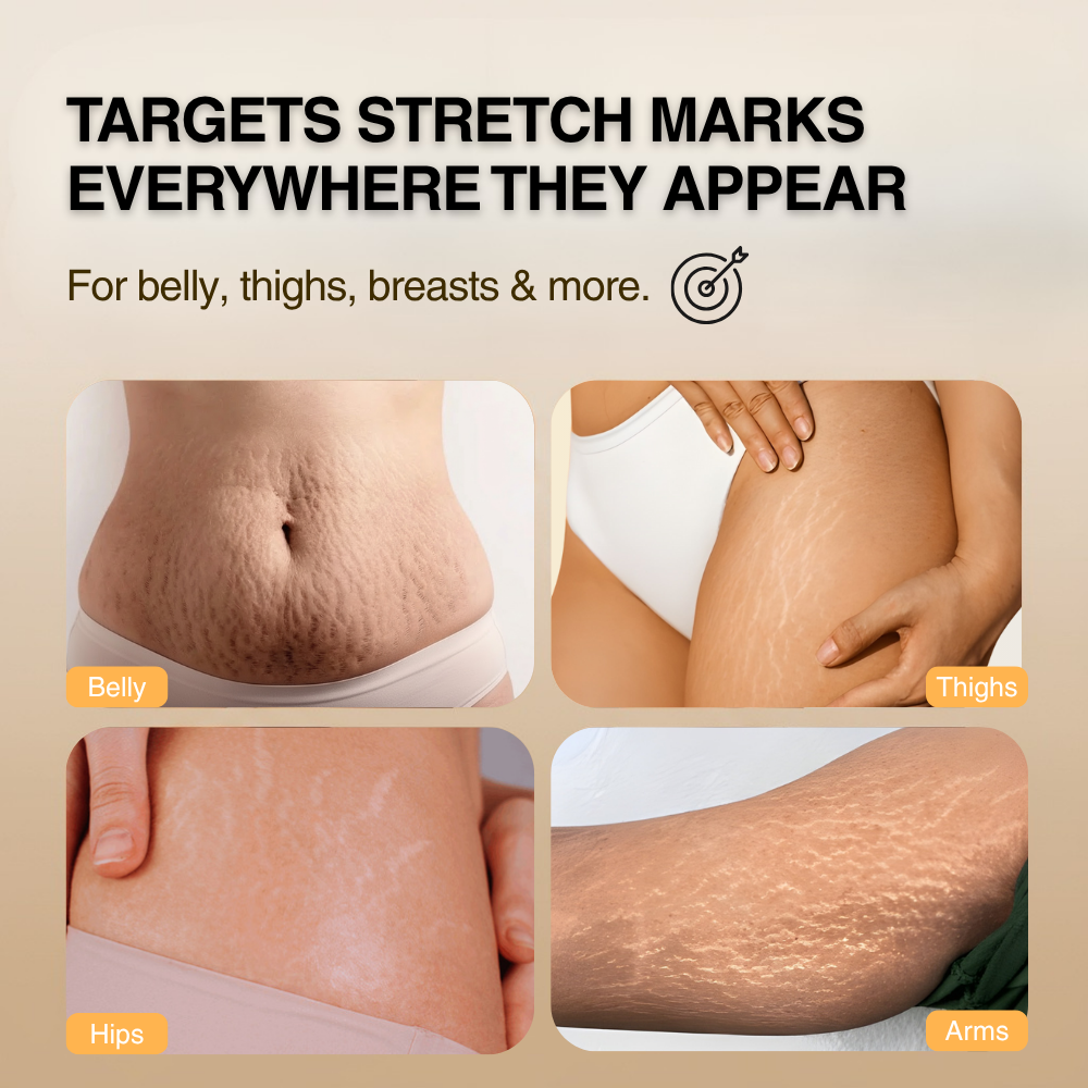 Stretch Mark & Scar Repair Cream