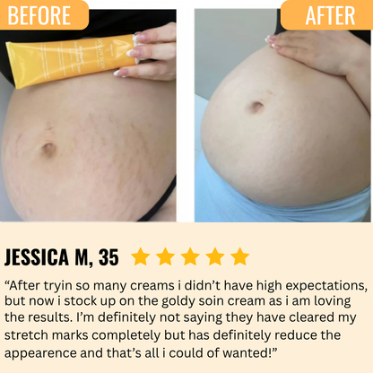 Stretch Mark BioRepair™ Cream